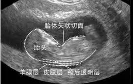 怀孕后第一次检查该挂什么号？原来这么多人都花过冤枉钱