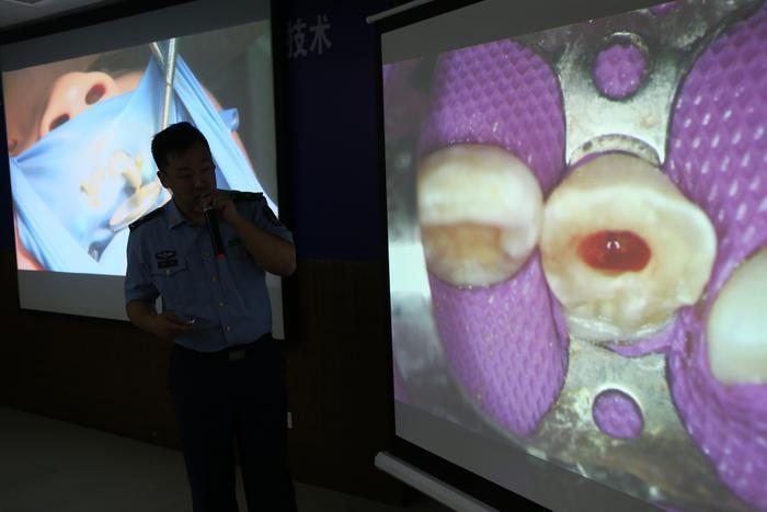 空军军医大学口腔医院再生牙,第四军医大学口腔医院牙髓再生