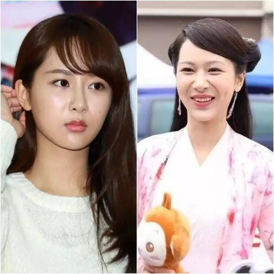 除了发量,最暴露年龄的可能是这两道纹