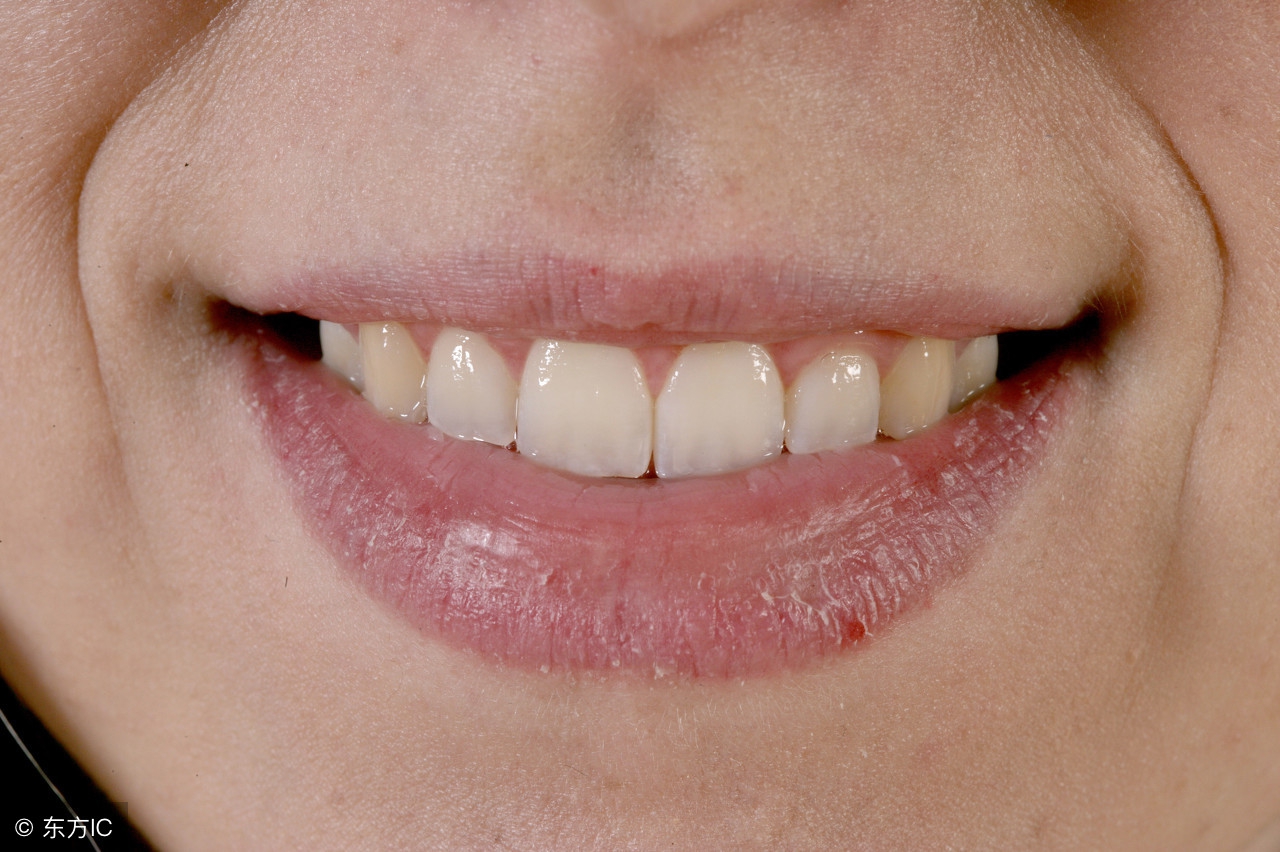 换季嘴唇干裂脱皮小妙招,秋冬嘴唇干燥起皮小妙招学生