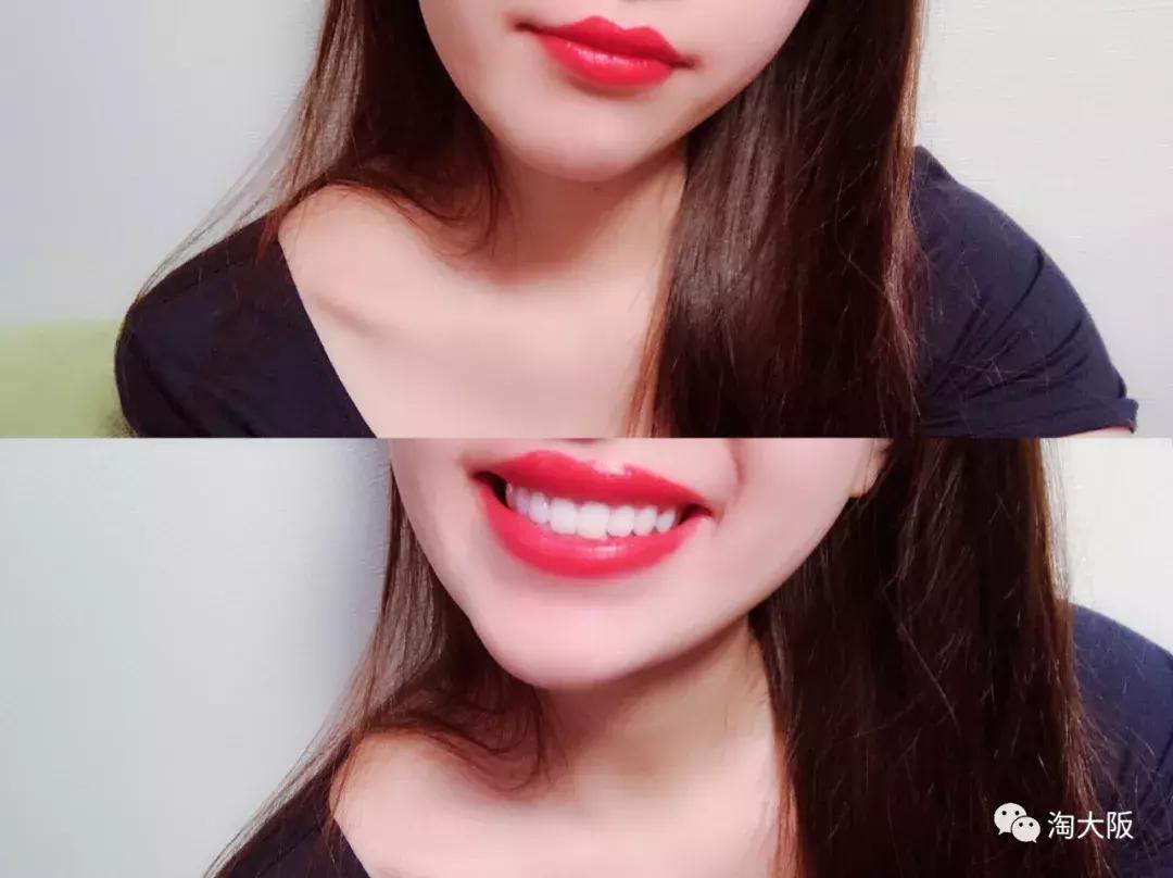 日本美白牙齿的牙膏,用过最好用的牙膏美白牙齿