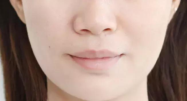 vc精华去法令纹,vc可以消除法令纹吗