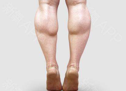 腿部臀部怎么训练才能匀称,锻炼臀部肌肉改善小腿外翻