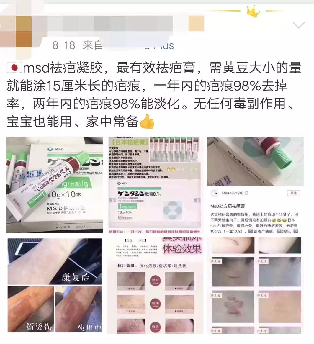 国产祛疤膏真的有效吗,日本的祛疤膏效果怎样