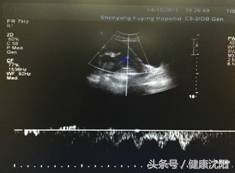 胎儿血管前置如何预防,孕妈课堂新生儿疾病筛查解读
