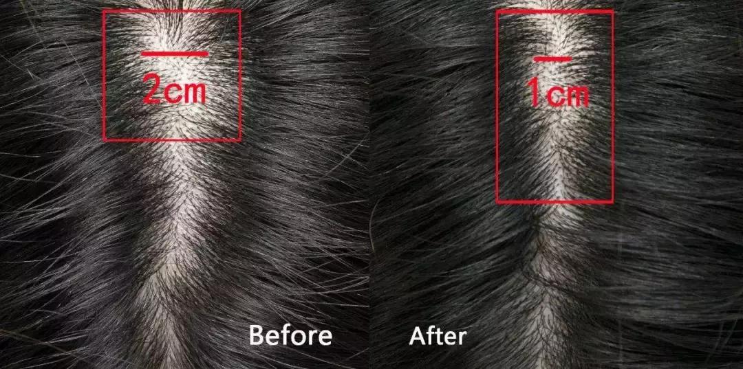 贝嫂与小贝,小贝和贝嫂在一起