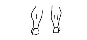 抖腿有啥病,抖腿是一种心理疾病