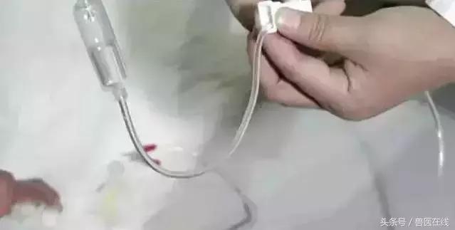 看图羊病,看图学经络