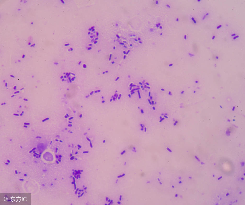 败血症的预防办法都有哪些呢？败血症要如何饮食