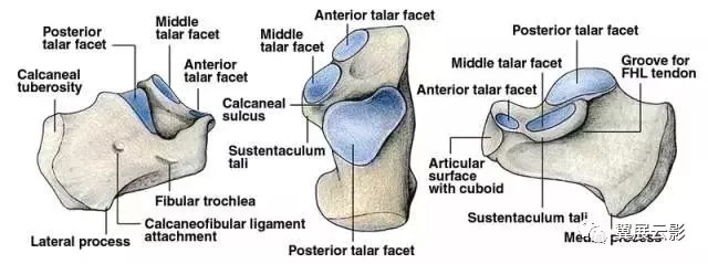 轻微骨裂容易被误诊,临床容易误诊的影像片子