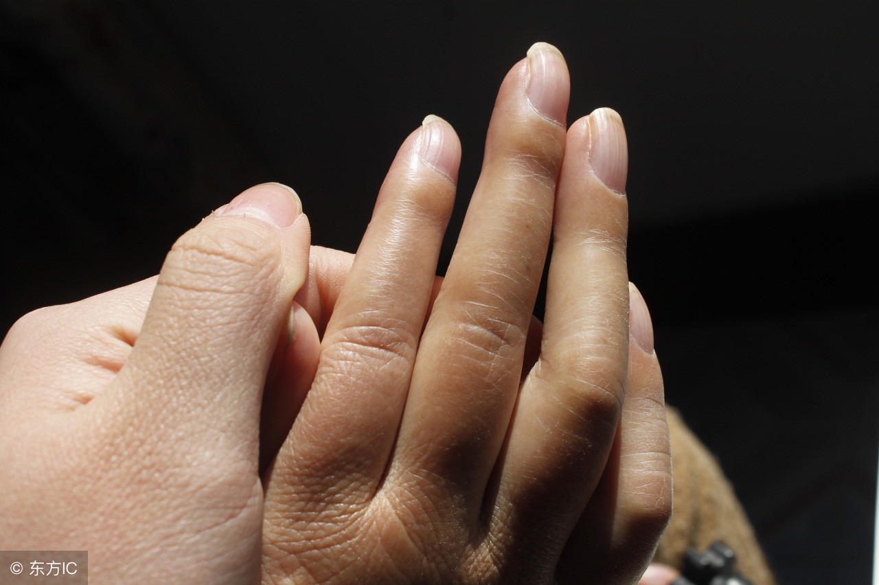 指甲薄做美甲容易得灰指甲吗,美甲之后感染灰指甲