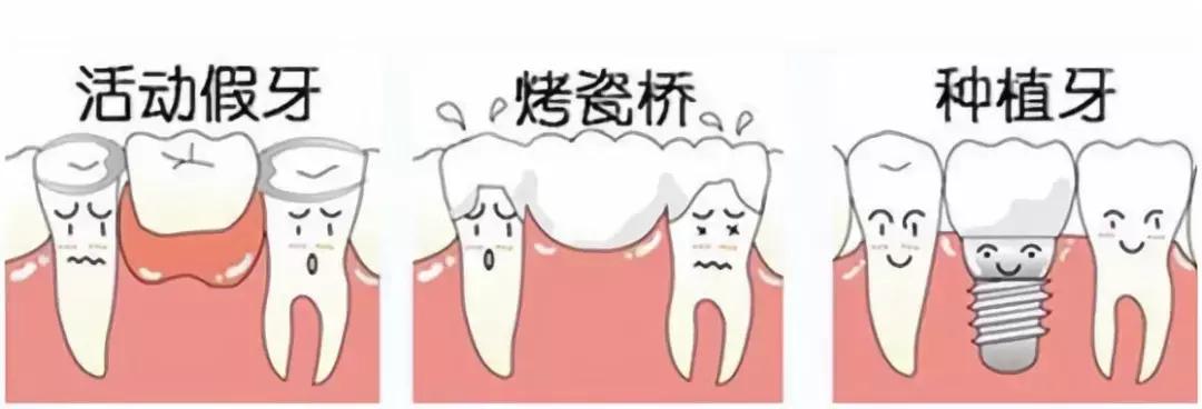 为什么会牙列缺失,口腔牙列缺失患者情况