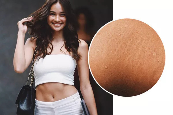 海兰最后妊娠纹恢复了么,海兰的妊娠纹怎么治好的