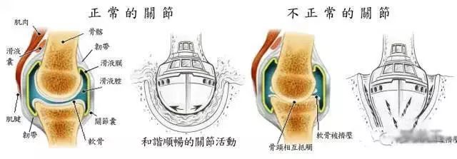 乳腺癌内分泌疗法的副作用有哪些,芳香化酶抑制剂男性乳腺癌