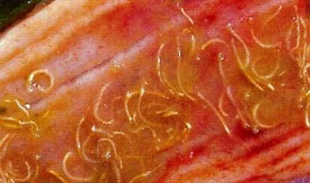 脑囊虫病是猪绦虫病吗,带绦虫虫卵特征