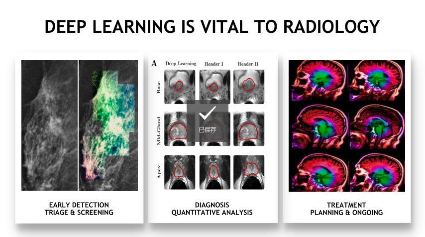 深度学习与医学影像,基于深度学习的医学影像分析