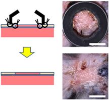 《自然》：太神了！科学家通过重编程得到皮肤干细胞，首次实现大面积创口原位皮肤再生｜科学大发现