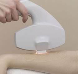 做完比基尼脱毛后注意事项,做完比基尼线脱毛注意事项