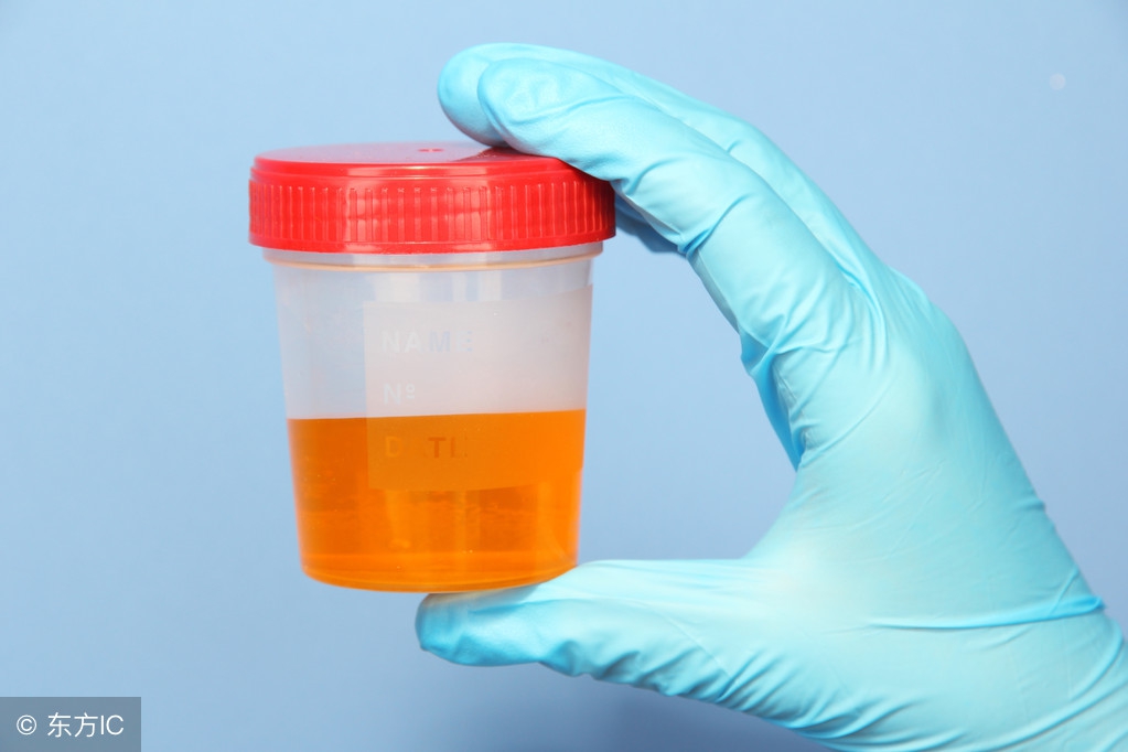 体检最常见的“尿检”非常重要，您知道它的意义吗