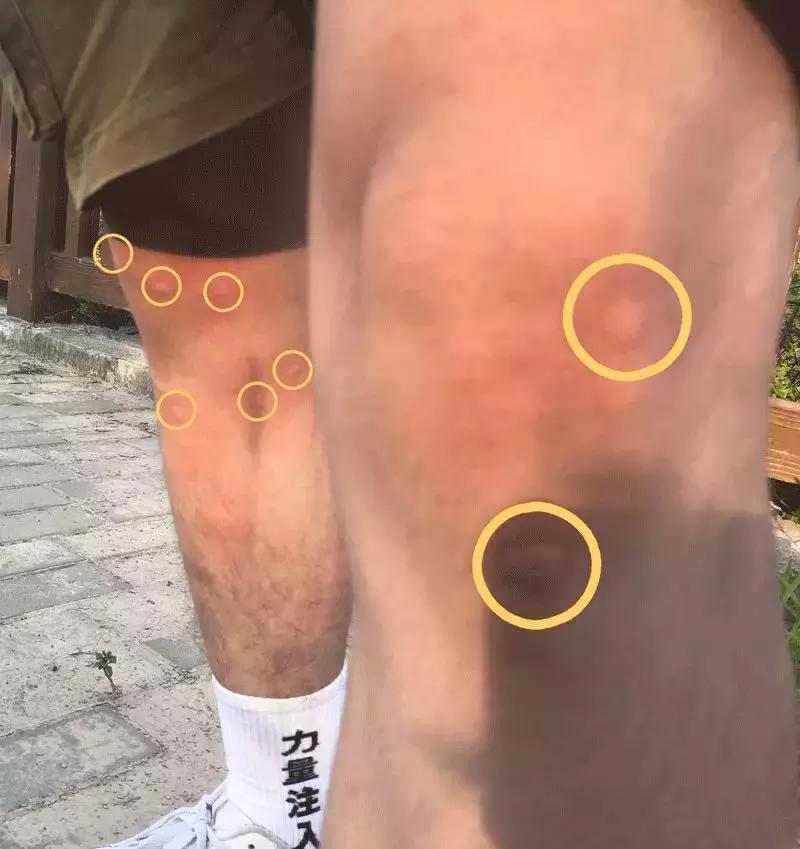 驱蚊灯驱蚊神器第一名评测,未来驱蚊神器测评