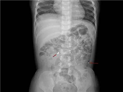 一些让人毛骨悚然拍到的照片,六个令人毛骨悚然的影像