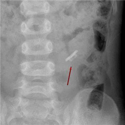 一些让人毛骨悚然拍到的照片,六个令人毛骨悚然的影像