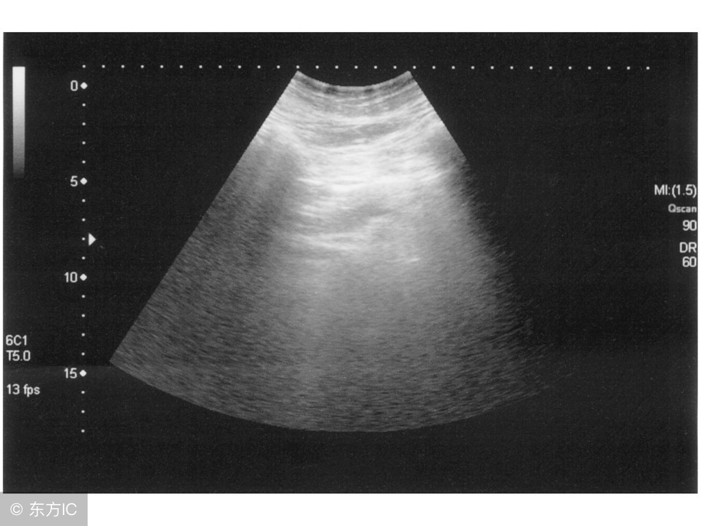 胆结石与胃病的区别,胆结石与胃病如何区分症状