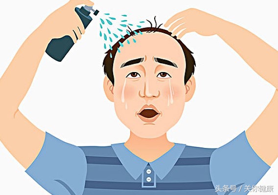 脱发医学治理,脱发最新药物研究突破