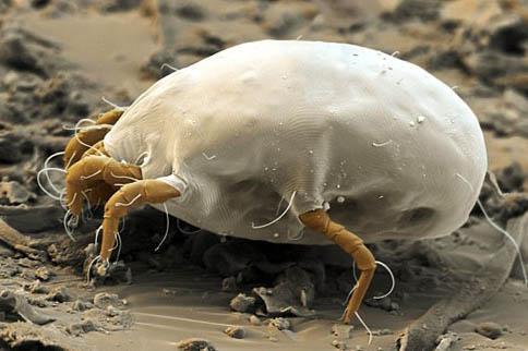 10W根头发，每个发根下有3只螨虫啃食发根头皮，掉发头痒不断