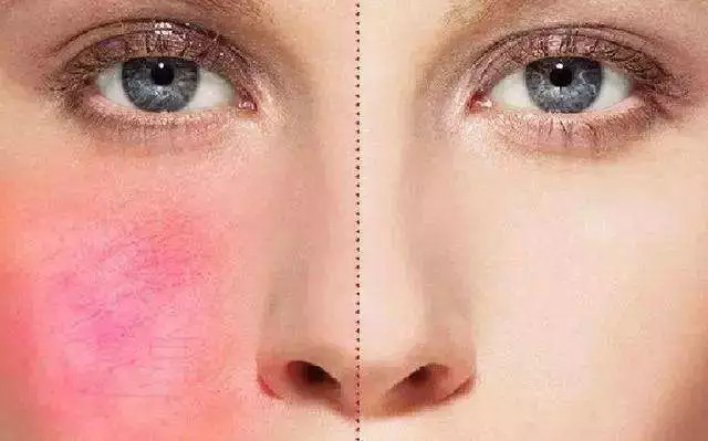 护肤成分大揭秘丨抗衰王牌阿魏酸