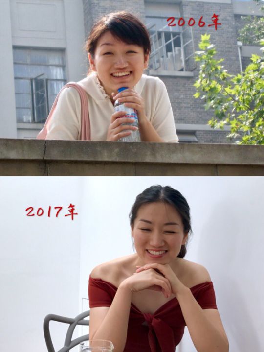 返场预告|第一次降价，Tripollar童颜机重塑脸部胶原，效果堪比医美级，如果一生只选一样美容品，必须就是它！