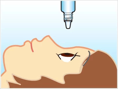 一颗泡腾片夺走18个孩子,一粒泡腾片引发的悲剧