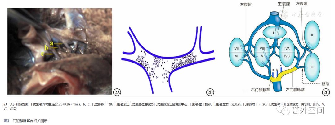 肝门解剖学特点是什么意思,肝门解剖结构示意图