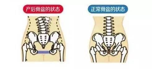 产后腰围能自动恢复吗,做了产后修复腰围少了3cm