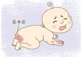 尿布疹的正确护理方法,出现尿布疹如何护理