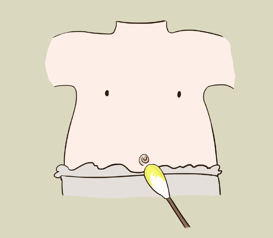 宝宝凸肚脐躺着的时候也是凸的吗,宝宝肚脐凸用什么办法