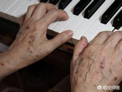 祛老年斑消除最快最有效方法,经常按摩哪里可以消除老年斑