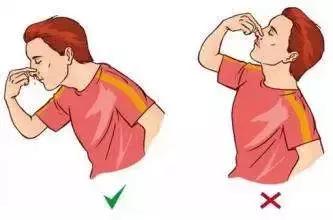 捏鼻防止偏曲,捏鼻子变高的危害