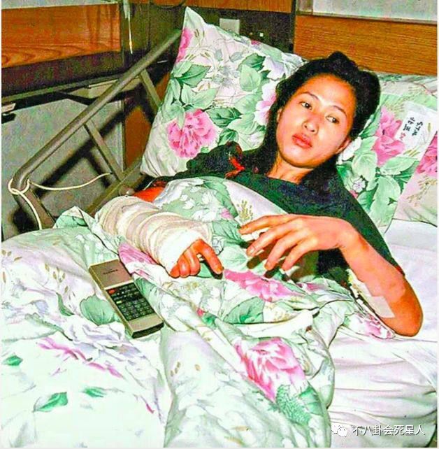 天生斜视参加选美，后成顶级打女被烧伤，当红时退圈为救患癌父亲