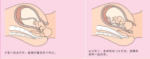 动画分娩过程科普,孕妈分娩的整个过程