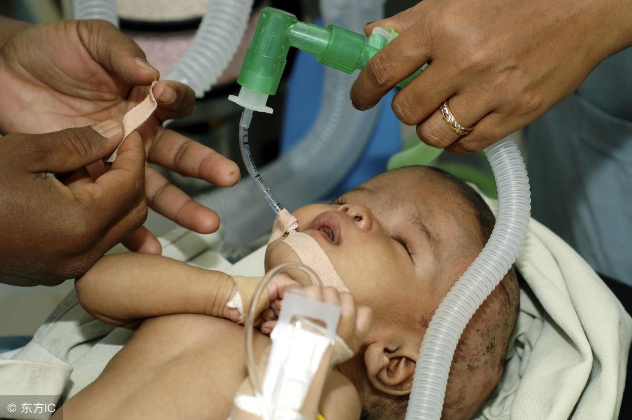 静止性脑积水脑积水会吸收吗,高颅压脑积水与低颅压脑积水