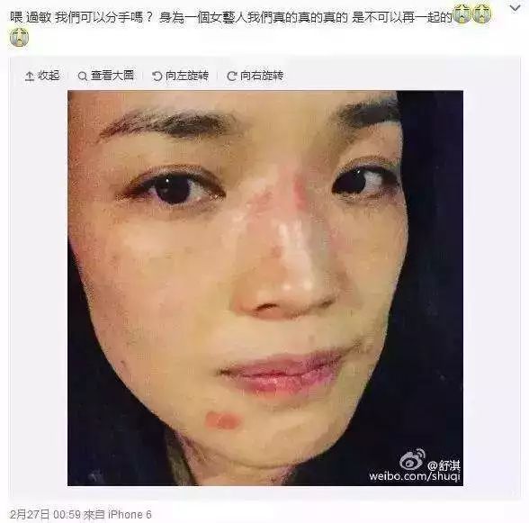 假期晒黑补救,假期出行晒黑皮