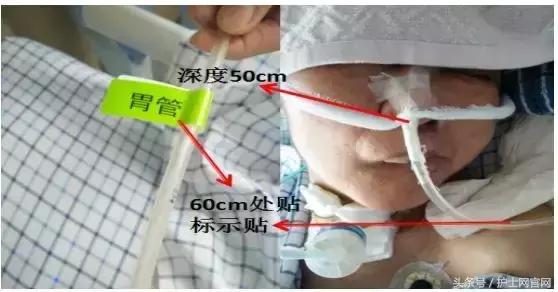 两条生命线一粗一细,两条生命线一细一粗