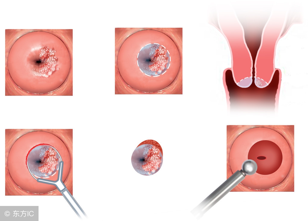 腹痛查出宫外孕、大出血！女性下腹痛的警讯，别以为只是腹痛了！