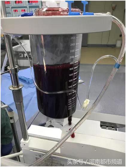 浙江16岁女孩莫名的腹痛,16岁女孩腹痛急救8小时后死亡