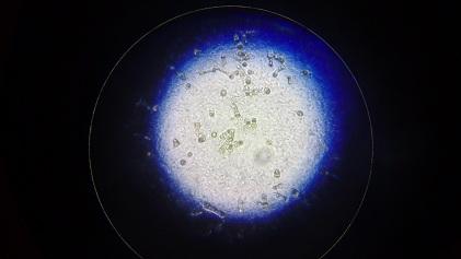 海参纤毛虫病特效药,海参纤毛虫烂眼