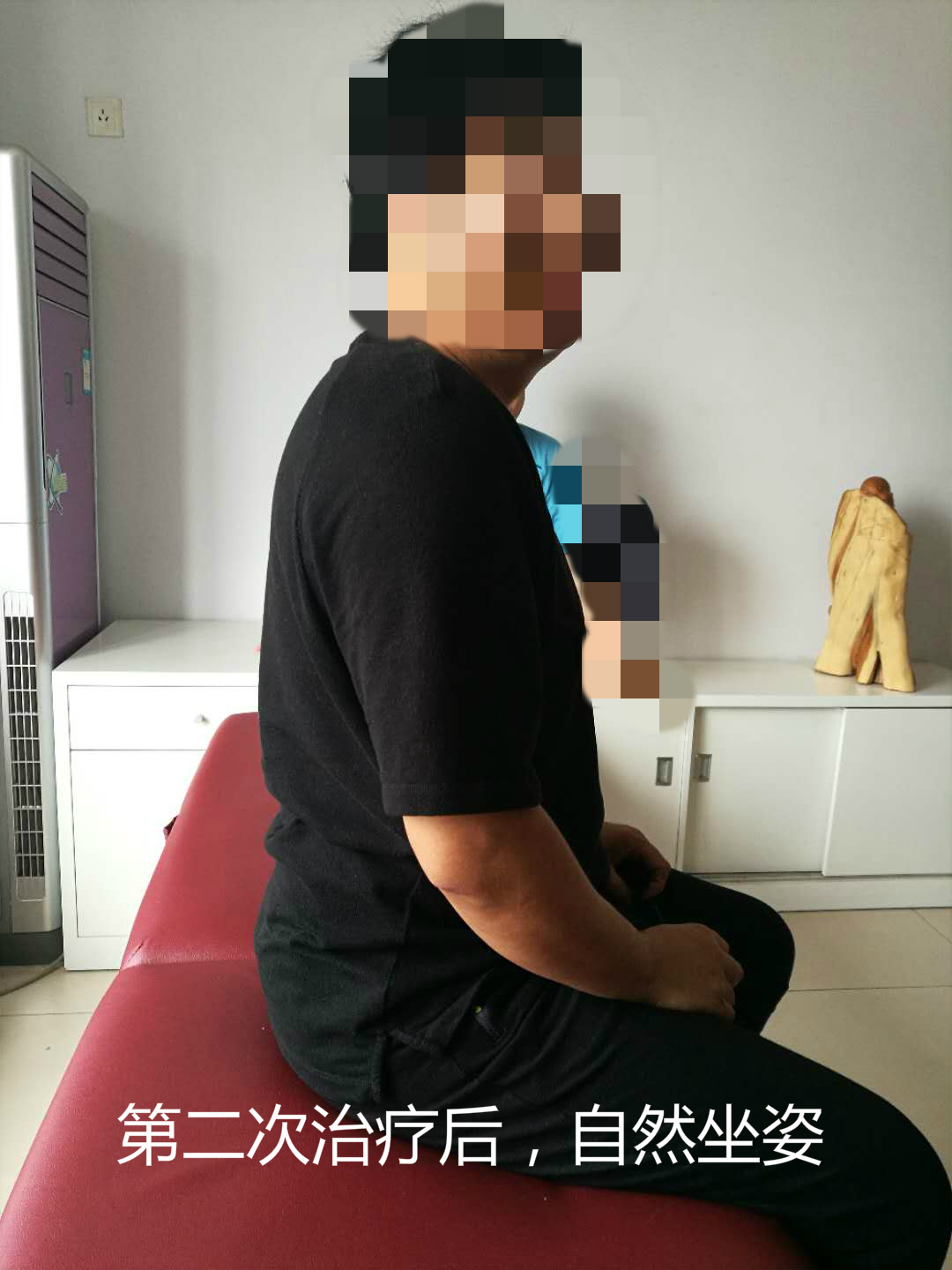 弯驼腰最好的治疗方法,弓腰驼背成人怎么矫正