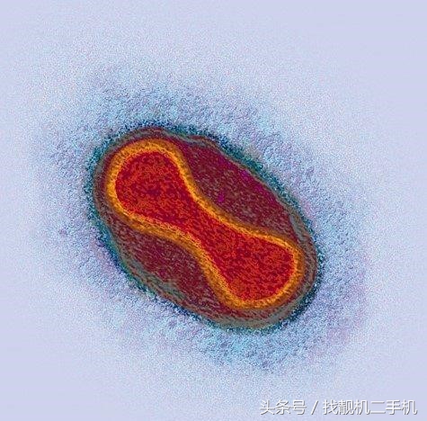 古代天花难治吗,古代天花大爆发