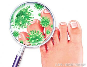 李师傅治疗脚气的视频,李医生治疗脚气视频