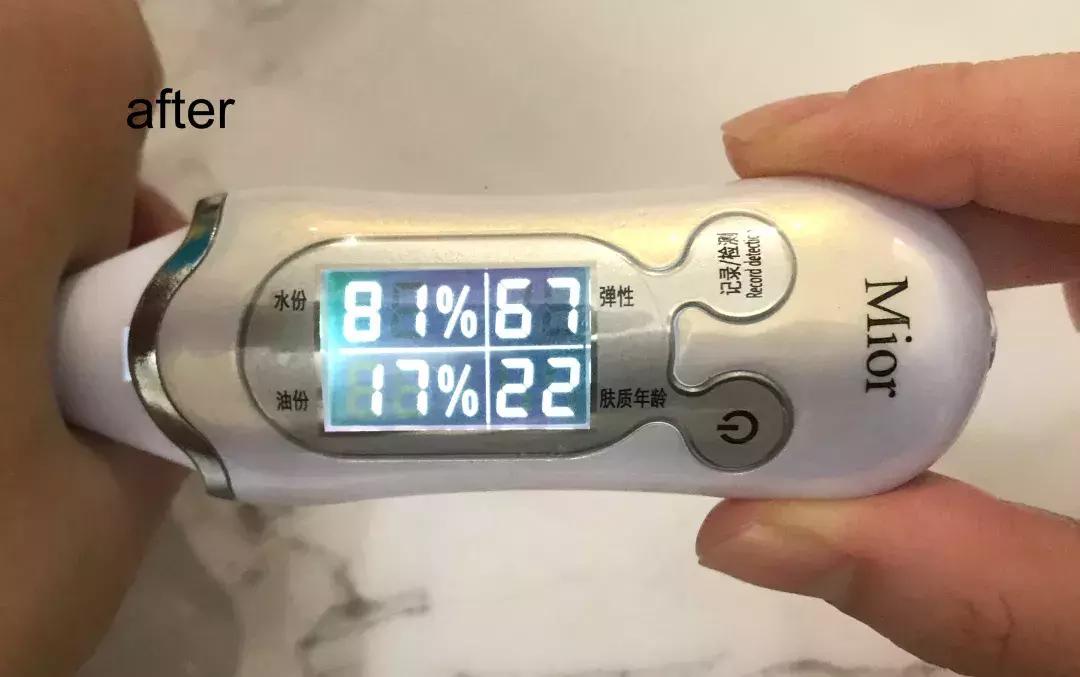 柔俪兰和小黑瓶肌底液,柔俪兰肌底液使用方法